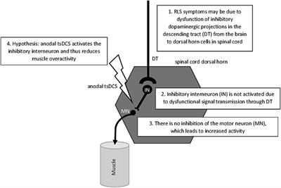 From brain to spinal cord: neuromodulation by direct current stimulation and its promising effects as a treatment option for restless legs syndrome